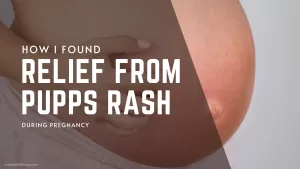 How I Found Relief From PUPPs Rash During Pregnancy